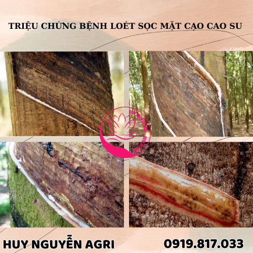 LOÉT SỌC MẶT CẠO CAO SU