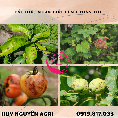 BỆNH THÁN THƯ
